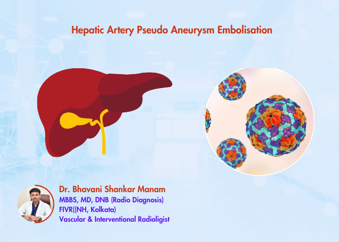 Hepatic Artery Pseudoaneurysm Embolisation