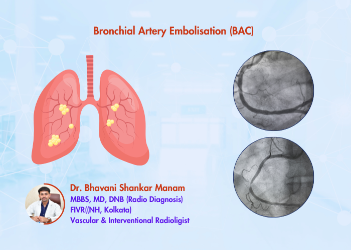 Bronchial Artery Embolisation